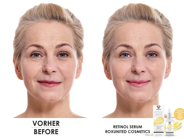 ROXUNITED Retinol Serum (30ml)