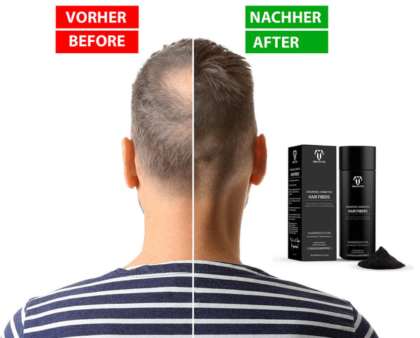 ROXUNITED Cosmetics Haarpuder / Streuhaar Premium zur Haarverdichtung 100% natürliche Baumwolle Männer & Frauen Schütthaar