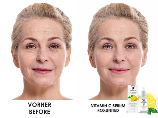 ROXUNITED Vitamin C Serum (30ml)